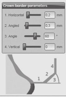 APLICAÇÃO Parâmetros das bordas no software CAD Observar que hajam suficientes espessuras de bordas. Valores recomendados são: _ 1. Espessura da borda (Horizontal): 0,2 mm _ 2.
