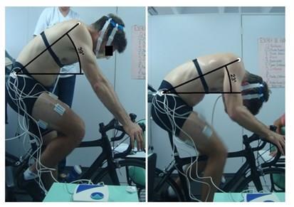 Tabela 1 Avaliação postural dos atletas pré e pós-teste em cicloergômetro.