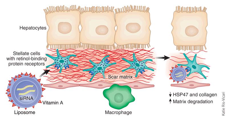 Figure 1 - Delivery of antifibrotic vitamin A coupled liposomes to hepatic stellate cells. Scott L Friedman, Nature Biotechnology 26, 399-400 (2008), doi:10.