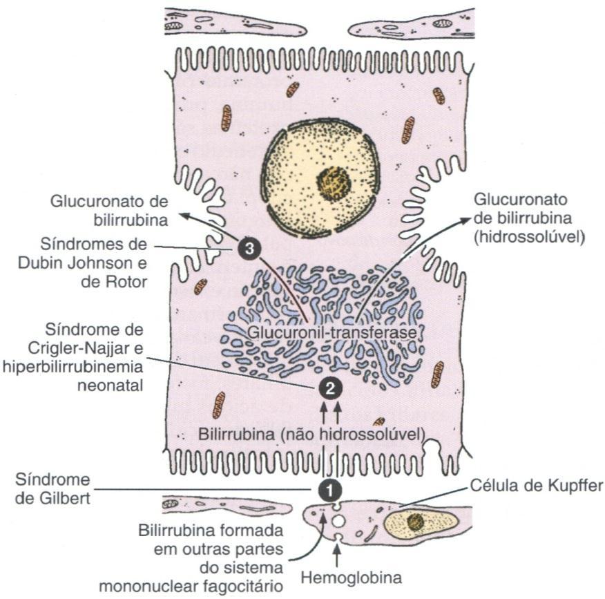 Síntese de bilirrubina ICTERÍCIA: excesso de glucuronato de bilirrubina no sangue Causas relacionadas com o