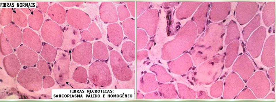 Organização da Célula Muscular