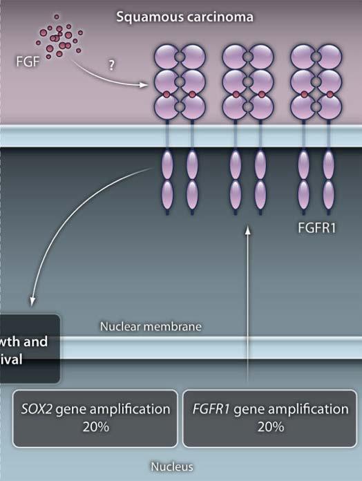 Amplificação de SOX2 (Sex Determining Region Y) e de FGFR1 (Fibroblast Growth Factor