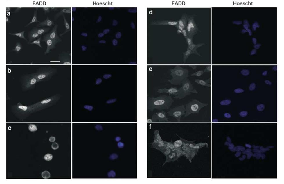 24 IMAGEM 1 - FADD SENDO EXPRESSO NO NÚCLEO E NO CITOPLASMA LEGENDA: Imagem por imunofluorescência da distribuição endógena de FADD em microscópio confocal de células HeLa (a e e), A549 (b), Jurkat
