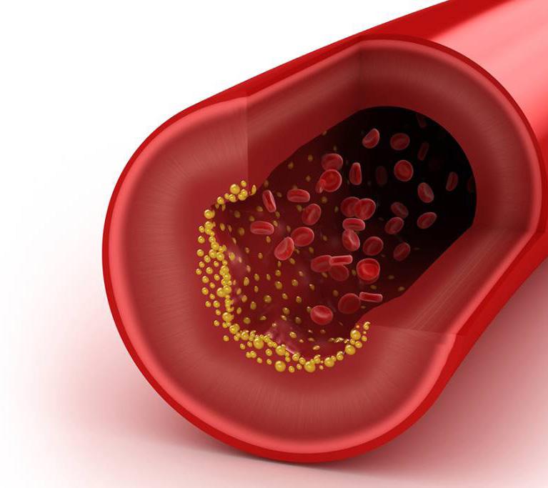 As Consequências Quando o colesterol total e o colesterol LDL se encontram elevados, aumenta o risco da sua deposição na parede dos vasos sanguíneos, desencadeando um processo inamatório que tende a