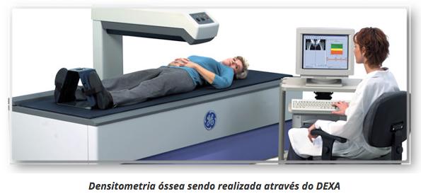 Densitometria Óssea com DEXA DEXA é uma sigla que significa absorciometria de feixe duplo de raios X, esse exame é capaz de avaliar muito além do percentual de gordura, pois ele também