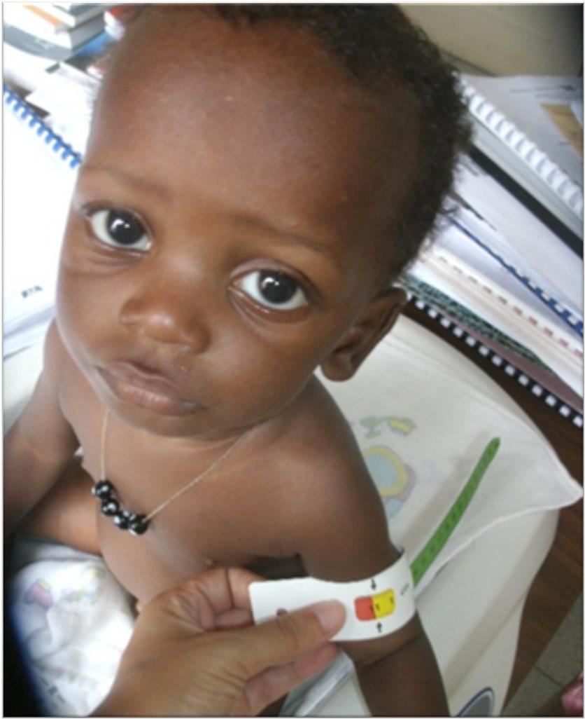 OBJECTIVOS 1. Melhorar a saúde nutricional materno-infantil 2. Reduzir a taxa de mortalidade infantojuvenil 3.