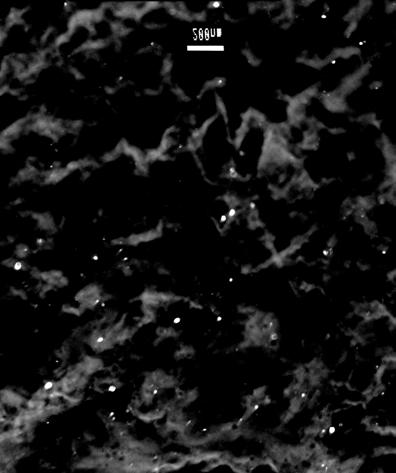 28 - Micrografia de réplica em filme de carbono mostrando a