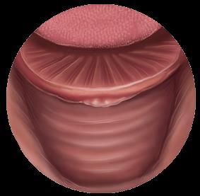 Base da língua Durante a deglutição, a epiglote dobra-se para