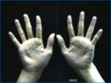 Evolução Primeira forma de mostrar uma quantidade: as mãos. A mão serviu como conjunto de comparação.