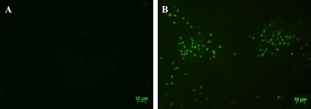 Figura 4.7. Microscopia de fluorescência da cavidade nasal de camundongo infectado com Dm28c-GFP.