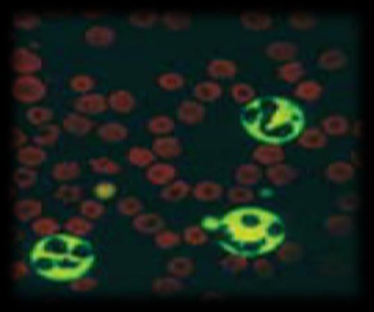 IFA - Detecta o antigénio p27 no citoplasma das células sanguíneas infectados (leucócitos