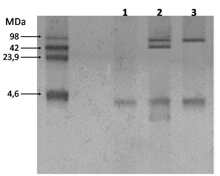 Análise Molecular do Experimento de Conjugação Eletroforese do DNA em gel de agarose das amostras A, B e da resultante da mistura M Atividade: