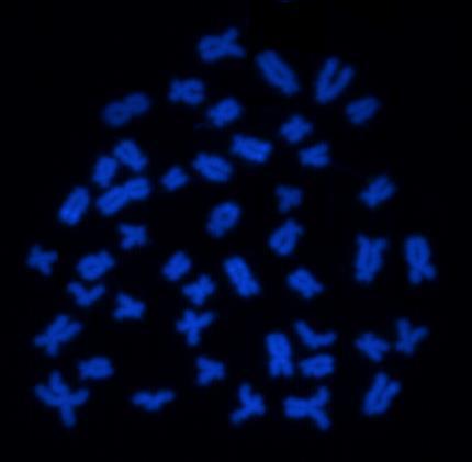 As setas indicam os Cromossomos B. Bar 10 µm.