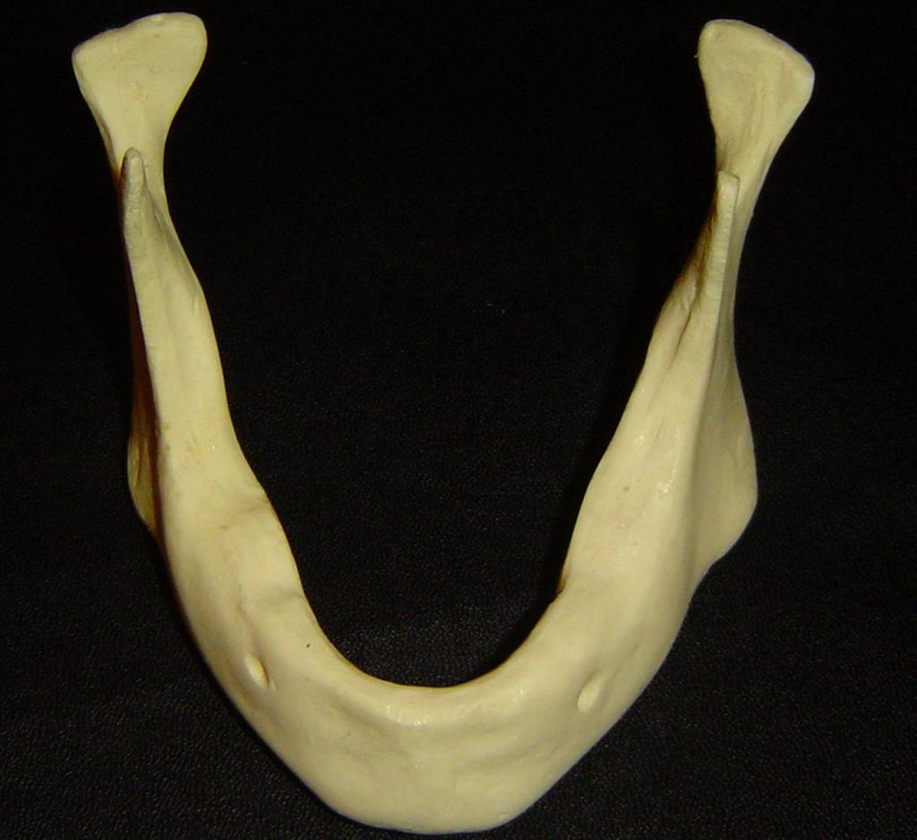 Figuras 2a e 2b - Réplicas de mandíbula humana utilizadas na pesquisa. Fonte: Dados da pesquisa. 4.