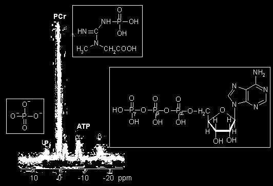 Espectro de RMN de 31 P de fosfatos em solução: