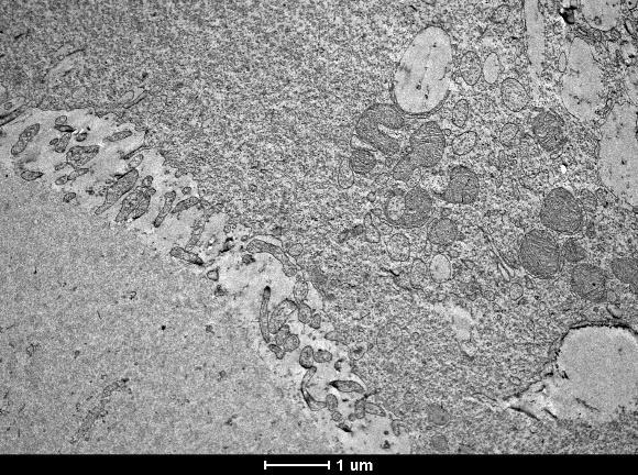 5.2.4 Ultraestrutura oocitária por microscopia eletrônica de transmissão Foram processados 20 oócitos por grupo para avaliação em microscopia