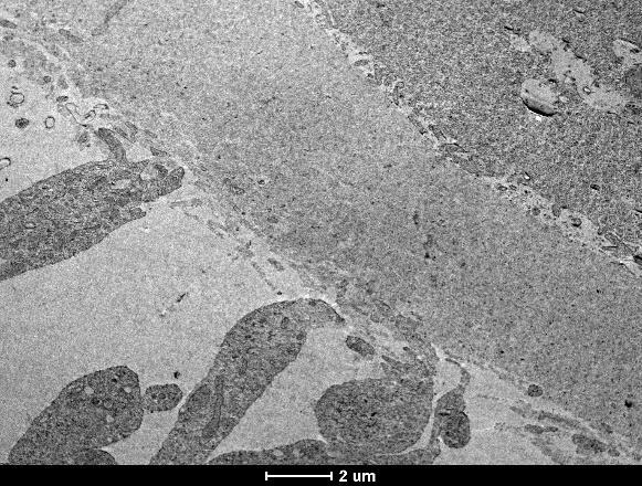 microvilosidades eretas em espaço perivitelínico aumentado (B), células do Cumulus expandidas (C), clusters de mitocôndrias associados a gotas