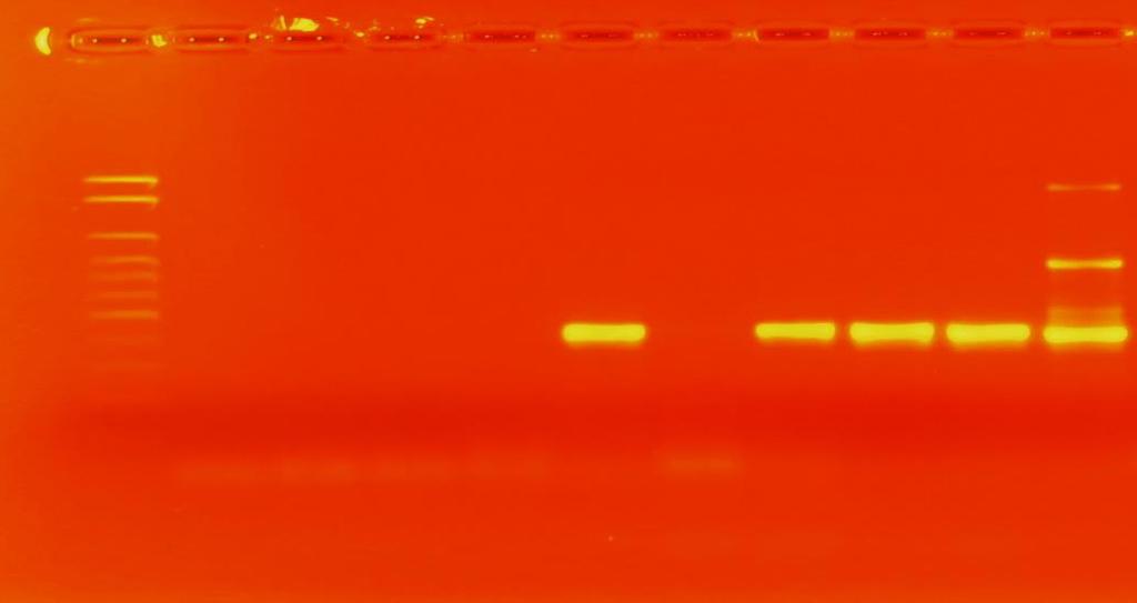 reação; amostras 50, 51, 54 e 47: cepas com resultado positivo para a PCR. A seta indica o produto amplificado de 390 pares de base referente ao gene blakpc-2.