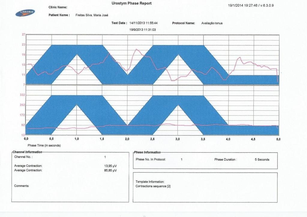 P3 Figura 22. Relatório gráfico do equipamento Urostin referente a EMG de superfície realizada no períneo da cliente P3 no primeiro durante a primeira consulta e na última consulta.