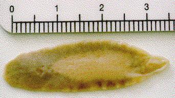 F.hepatica, vermes adultos,no exame macroscópio( 2-5 cm