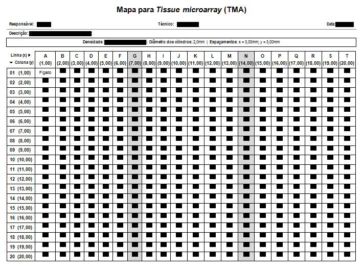 Materiais e Métodos 43 Figura 1. Mapa de TMA para identificação dos casos para análise dos resultados de imuno-histoquímica.