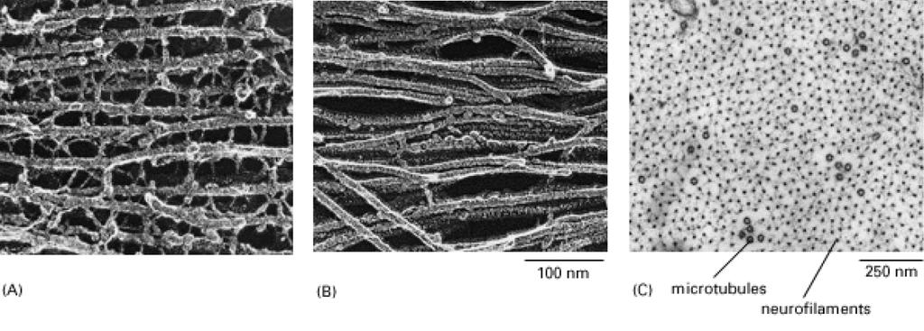 Neurofilamentos