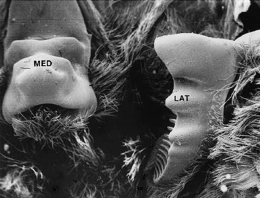 MELO, M. A. Desenvolvimento e Morfologia Funcional de Estômagos de Larvas... 9 O tipo mais simples de moinho gástrico é encontrado na infra-ordem Penaeidea.
