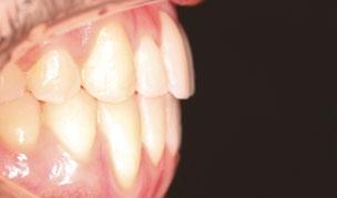 corrigido e melhorado ao nível da oclusão dentária e das posturas miofuncionais orais.