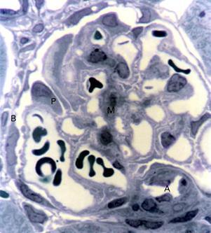 T. Montanari, UFRGS Figura 10.