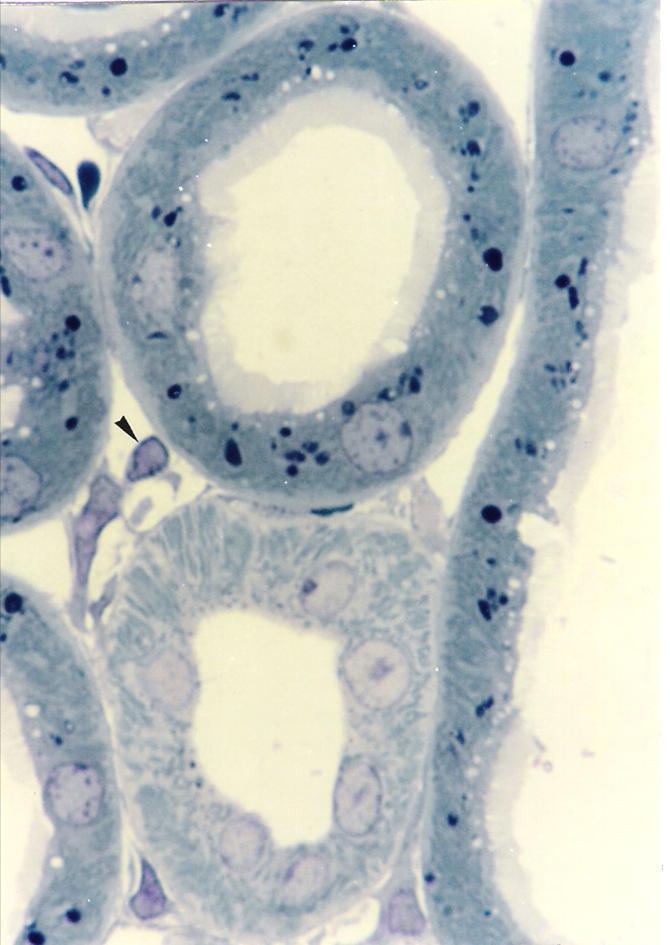 T. Montanari, UFRGS T. Montanari, UFRGS Figura 10.