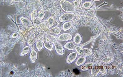 31 Figura 1 - - Microrganismos típicos de Lodos Ativados: (1) Colônia de Protozoários