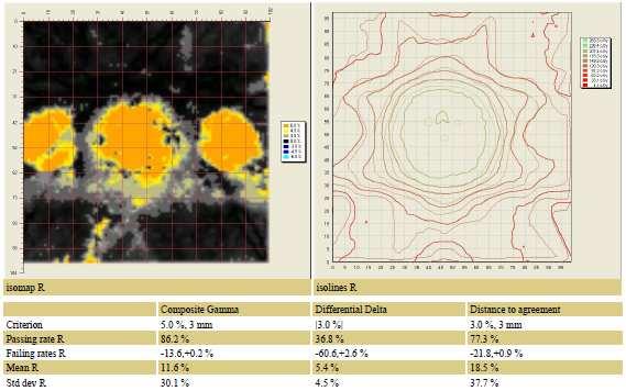 Figura 4.38 - Resultado da análise feita pelo software FilmQA Pro 2011 do filme EBT2 irradiado na instituição 1 usando o critério para o índice gama de 5%-3mm.