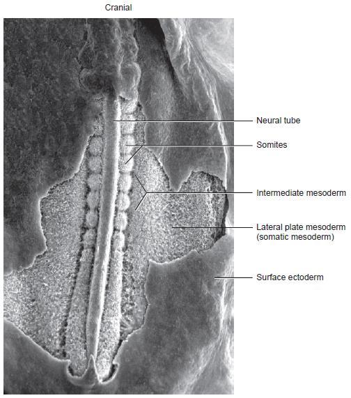 Formação de vários tipos de mesoderma, dos somitos e do celoma intra-embrionário Microfotografia que mostra os somitos, o mesoderma intermediário e o mesoderma lateral