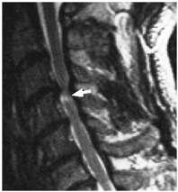 Fisiopatologia