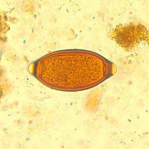 c) O ciclo de vida desses vermes é do tipo heteroxênico. O ovo (1) do mede 150 micrômetros e é eliminado nas fezes do homem, sendo a forma diagnóstica encontrada no Exame Parasitológico de Fezes.