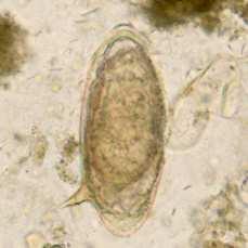 a) Ascaridíase b) Estrongilodíase c) Enterobiose d) Esquistossomose e) Tricuríase. 10.