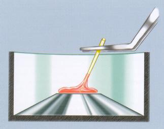 Paramonoclorofenol Canforado Técnica de uso Cone de