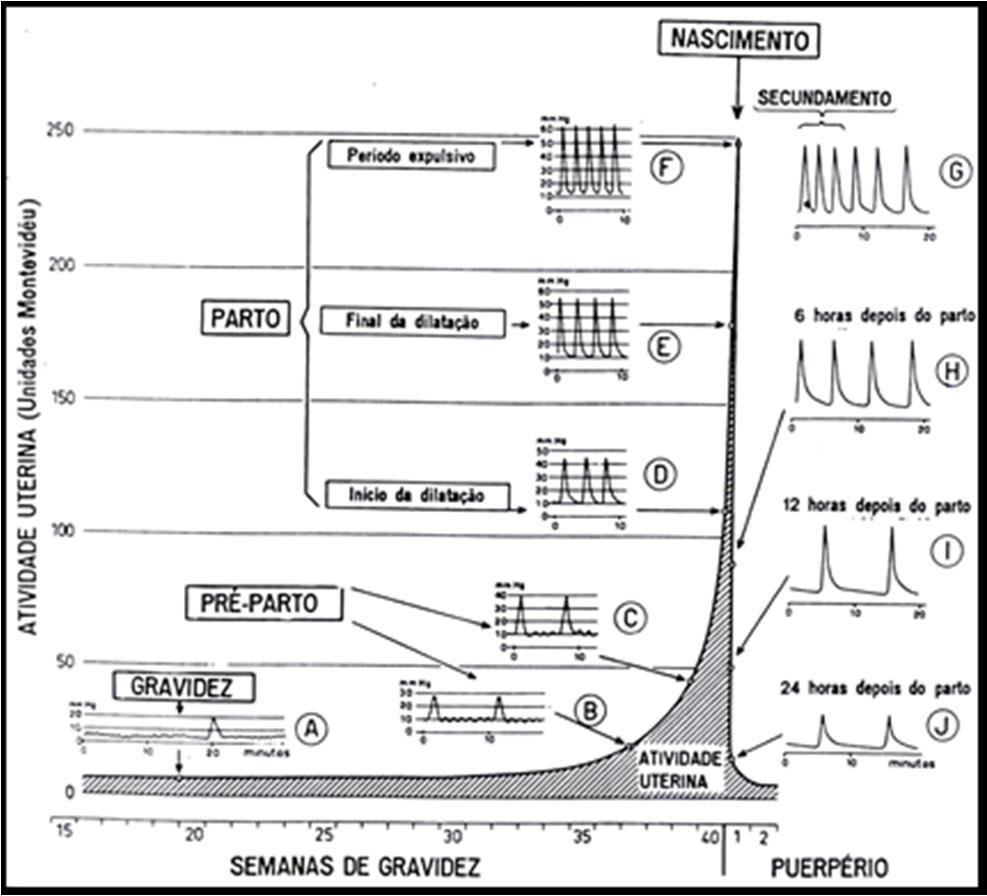 Características das Contrações Uterinas freqüência: na gravidez: pequenas contrações de até 30 seg.