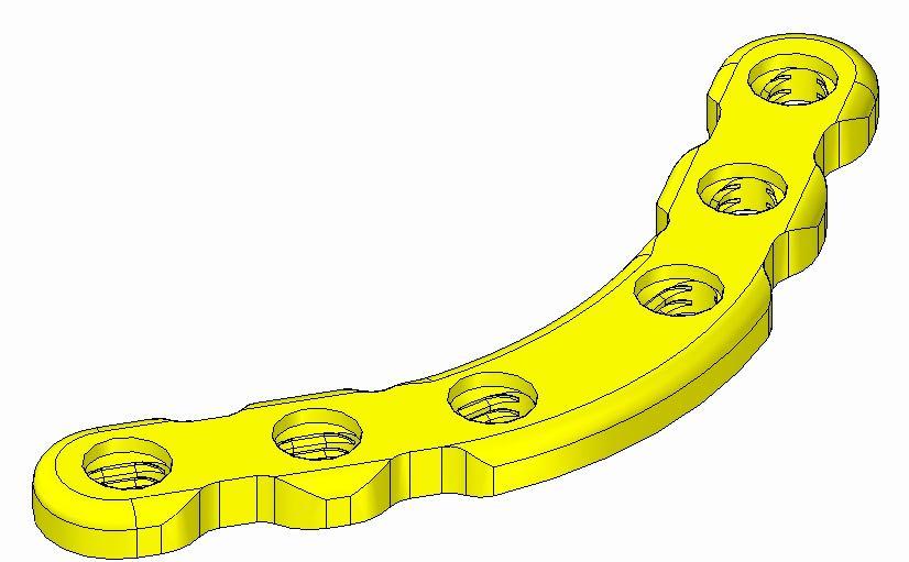 PLACA RETA LOCKPLAN PLACA RETA LOCKPLAN 102.24100 Placa Reta 4 furos Lockplan 2,4mm 102.24101 Placa Reta 5 furos Lockplan 2,4mm 102.24102 Placa Reta 6 furos Lockplan 2,4mm 102.