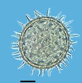 ); Lythraceae (M - (VP)