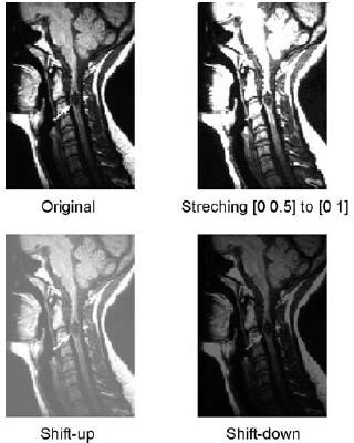 Exemplo para uma Imagem Medica Para um ajuste Linear de uma Imagem Medica O ajuste