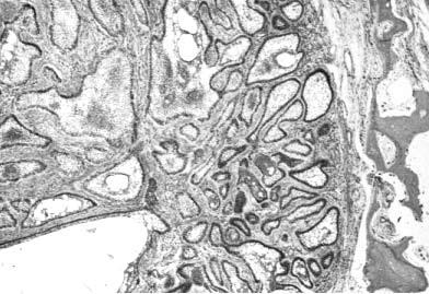 Ameloblastoma: revisão de literatura. histológico e a evolução terapêutica, e mesmo o prognóstico.