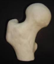 O osso cortical tem espessura não uniforme ao longo da extremidade proximal do fémur, sendo maior na área inferior do colo do fémur (Mavhew et al, 25; Williams and Warwick 1995).