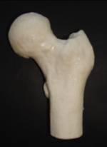 O fémur é dos ossos do corpo humano que sofre com maior intensidade diferentes cargas em diferentes posições.
