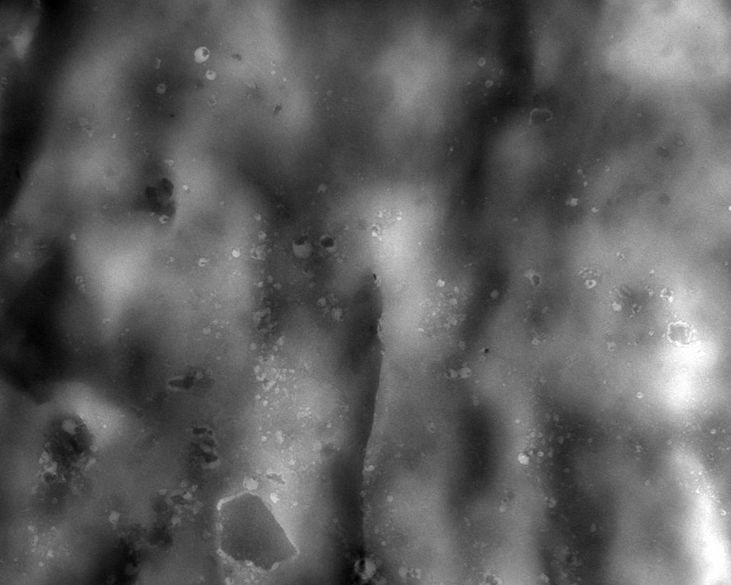 174 500 nm 500 nm Figura118: Microscopia obtidas por TEM para compósito amido/argila Cloisite 30B com 2 % de argila 5.2.12 