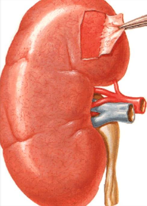 vasos; ureter v.