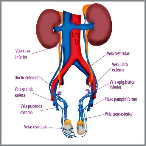 Quadro clínico: Massa abdominal Hematúria Dor em flanco Tríade