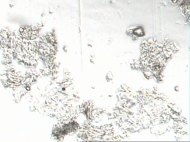 Figura 2 - Caracterização microscópica do resíduo fermentado de mandioca.
