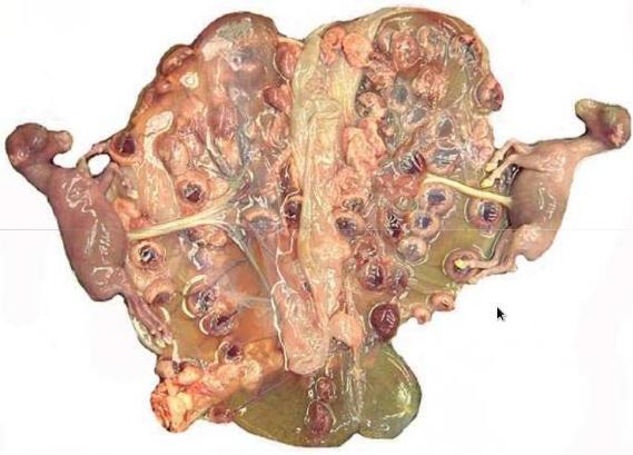 19 Figura 5: Placenta caprina e suas carúnculas em formato convexo. Fonte: Pereira (2015). 2.3.