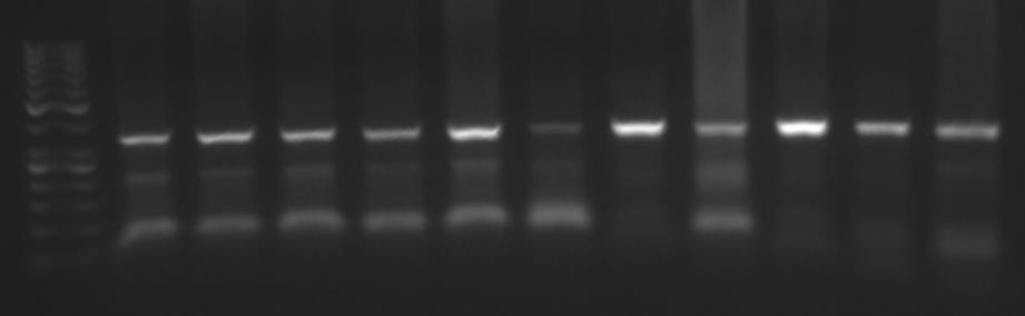 sendo: PTCR1 (5 - TCTAGAAACAGTTGCCTGGC-3 ) (2 µl) e PTCR2 (5 -ATAGCACTGGGAGCATTGAAGC- 3 ) (2 µl) (Invitrogen, USA), Taq DNA polimerase recombinante (5 U/µL) (0,5 µl) (Invitrogen, Brasil); e DNA